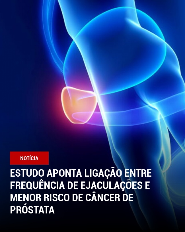 Estudo aponta ligação entre frequência de ejaculações e menor risco de câncer de próstata