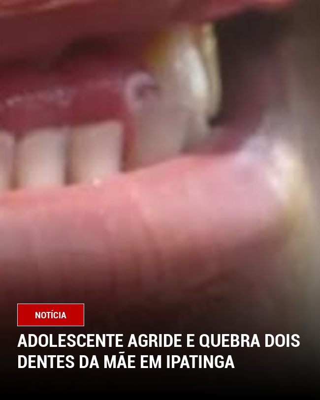 Adolescente agride e quebra dois dentes da mãe em Ipatinga