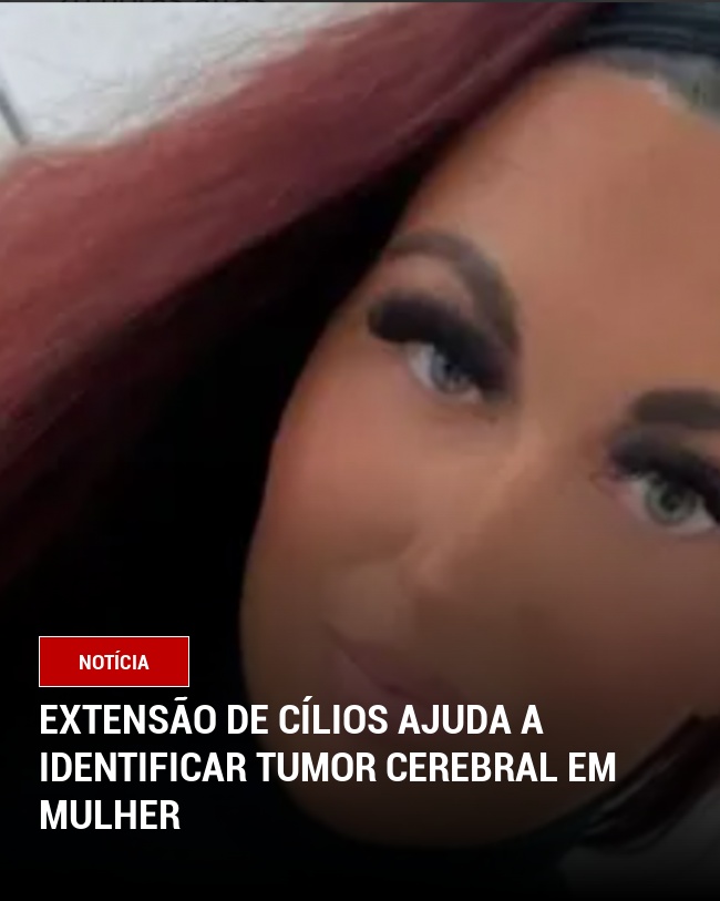 Extensão de cílios ajuda a identificar tumor cerebral em mulher