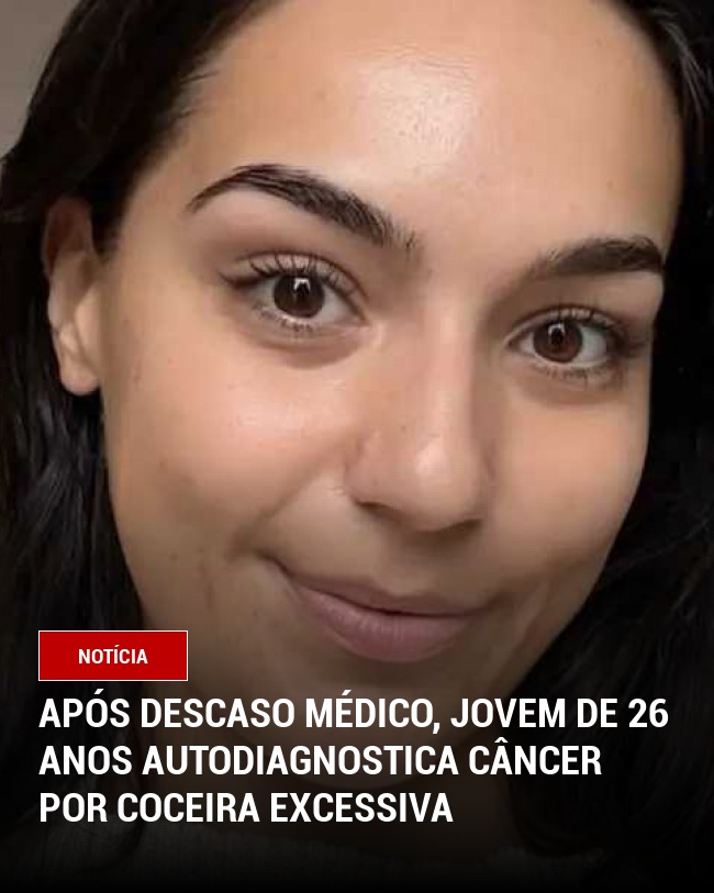 Após Descaso Médico, Jovem de 26 Anos Autodiagnostica Câncer por Coceira Excessiva