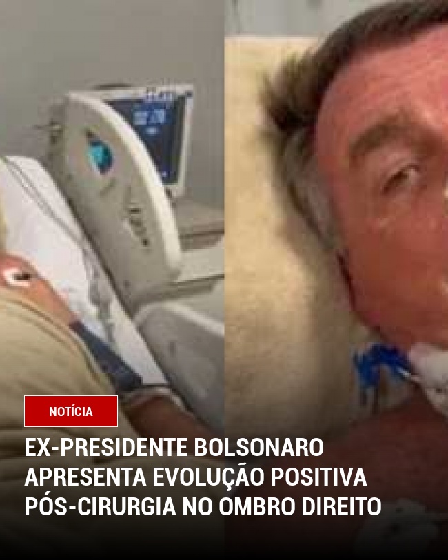 Ex-presidente Bolsonaro Apresenta Evolução Positiva Pós-Cirurgia no Ombro Direito