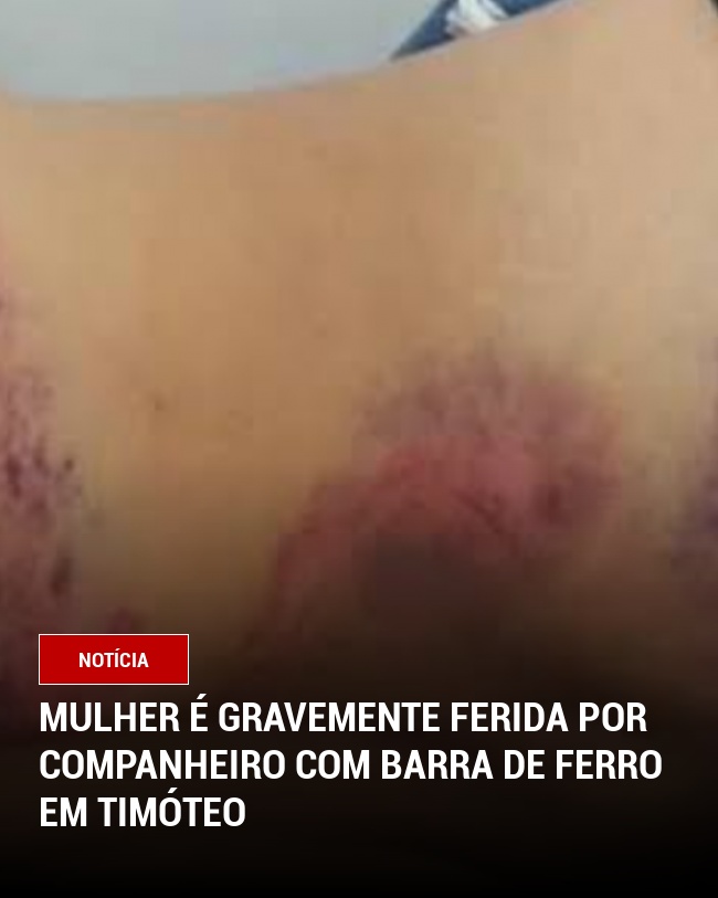 Mulher é gravemente ferida por companheiro com barra de ferro em Timóteo