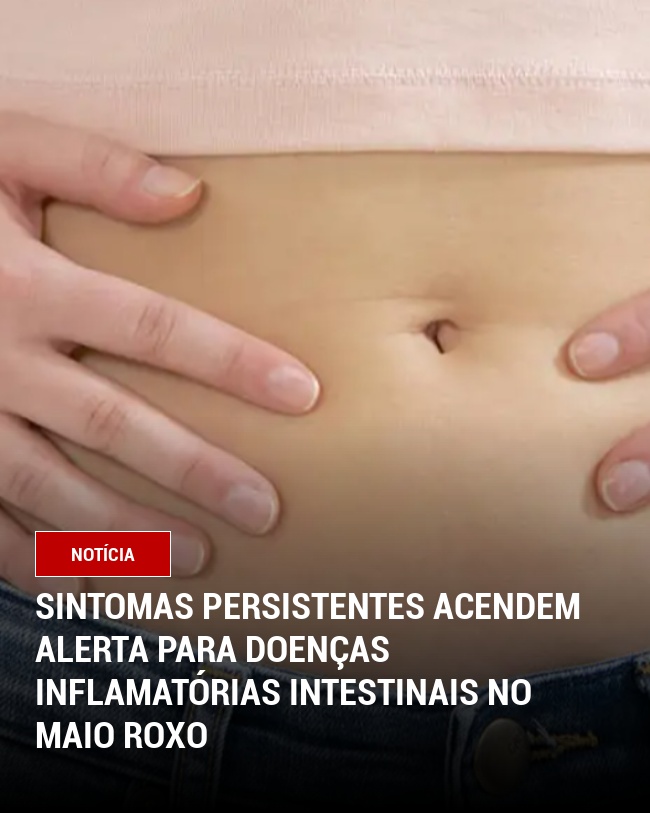 Sintomas Persistentes Acendem Alerta para Doenças Inflamatórias Intestinais no Maio Roxo