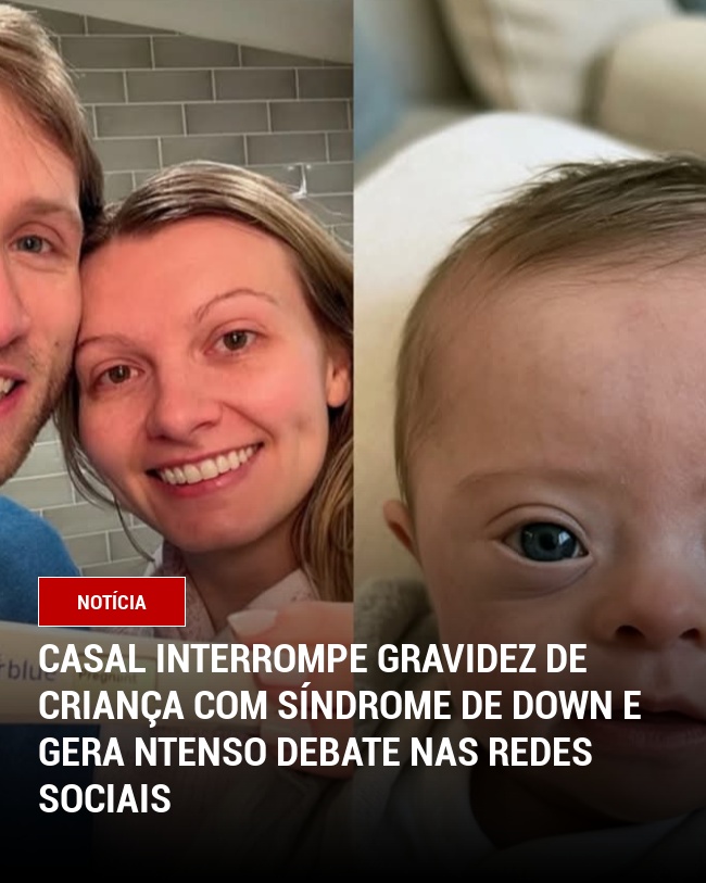 Casal interrompe gravidez de criança com síndrome de down e gera ntenso debate nas redes sociais