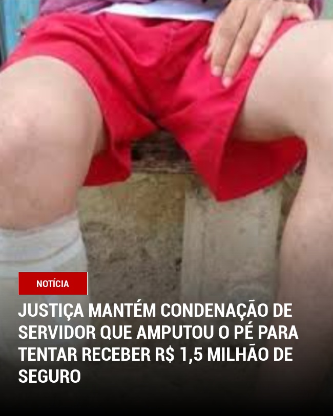 Justiça mantém condenação de servidor que amputou o pé para tentar receber R$ 1,5 milhão de seguro