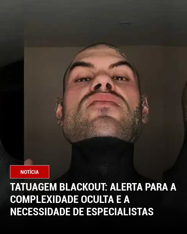 Tatuagem Blackout: Alerta para a Complexidade Oculta e a Necessidade de Especialistas