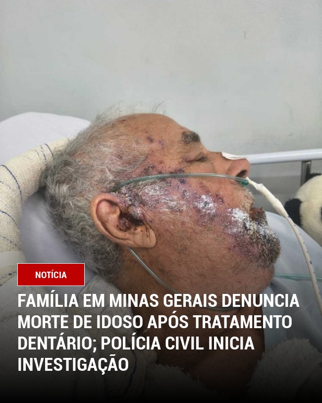Família em Minas Gerais denuncia morte de idoso após tratamento dentário; Polícia Civil inicia investigação