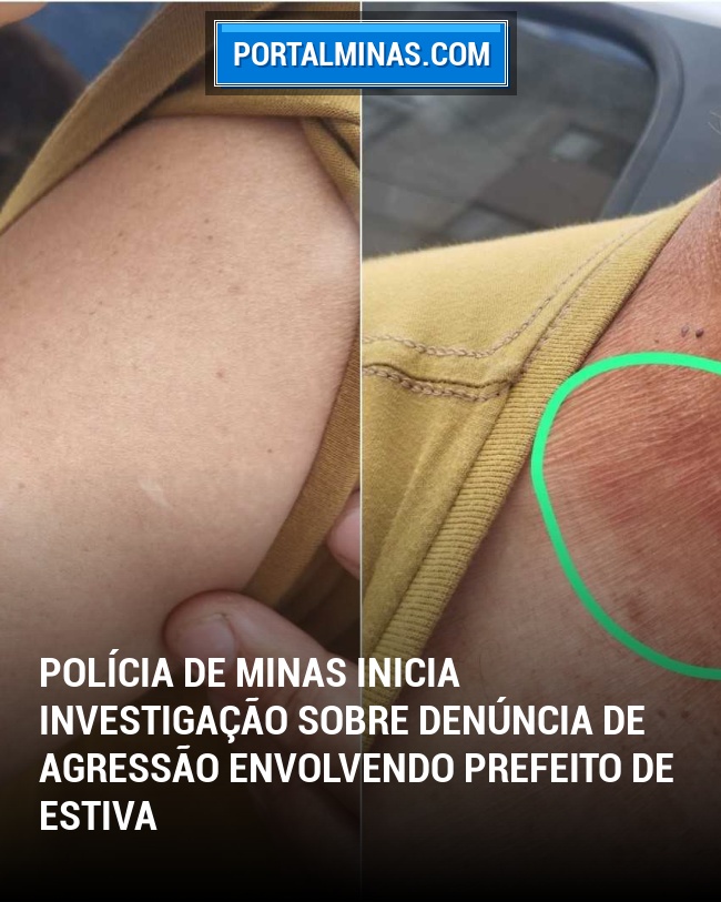 Polícia de Minas inicia investigação sobre denúncia de agressão envolvendo Prefeito de Estiva