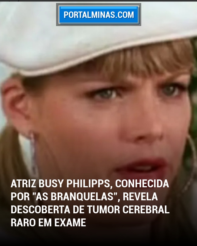 Atriz Busy Philipps, Conhecida por "As Branquelas", Revela Descoberta de Tumor Cerebral Raro em Exame
