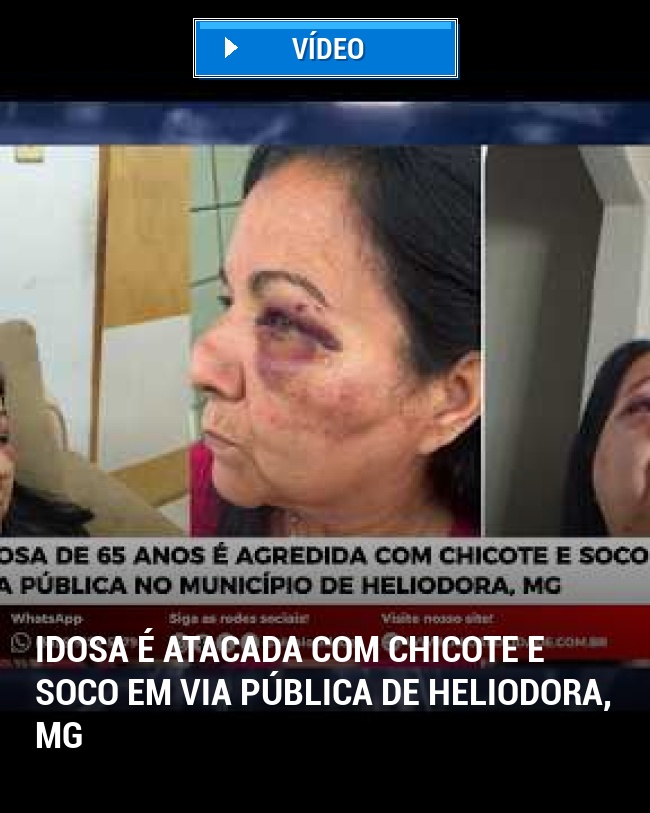 Idosa é Atacada com Chicote e Soco em Via Pública de Heliodora, MG