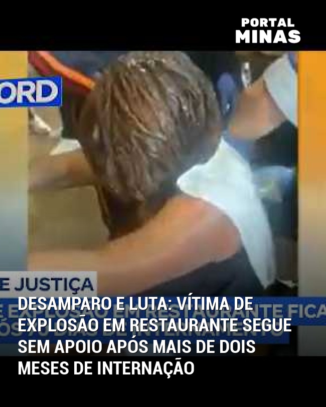Desamparo e Luta: Vítima de Explosão em Restaurante Segue Sem Apoio Após Mais de Dois Meses de Internação