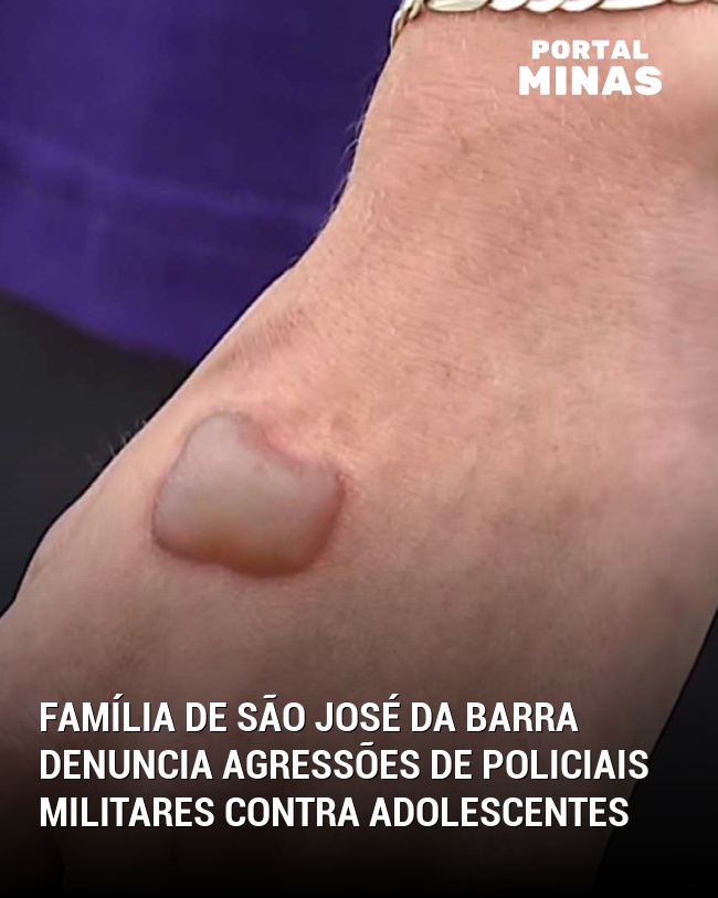 Família de São José da Barra Denuncia Agressões de Policiais Militares contra Adolescentes