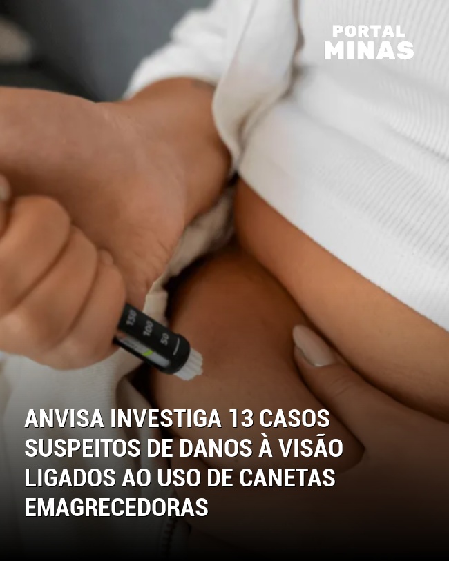 Anvisa investiga 13 casos suspeitos de danos à visão ligados ao uso de canetas emagrecedoras