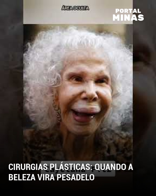 Cirurgias plásticas: quando a beleza vira pesadelo