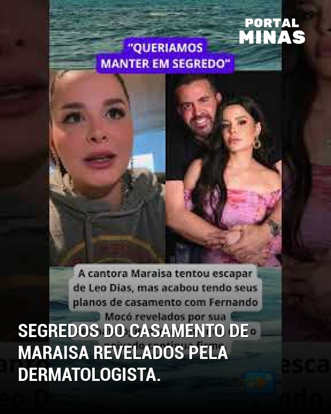 Segredos do casamento de Maraisa revelados pela dermatologista.