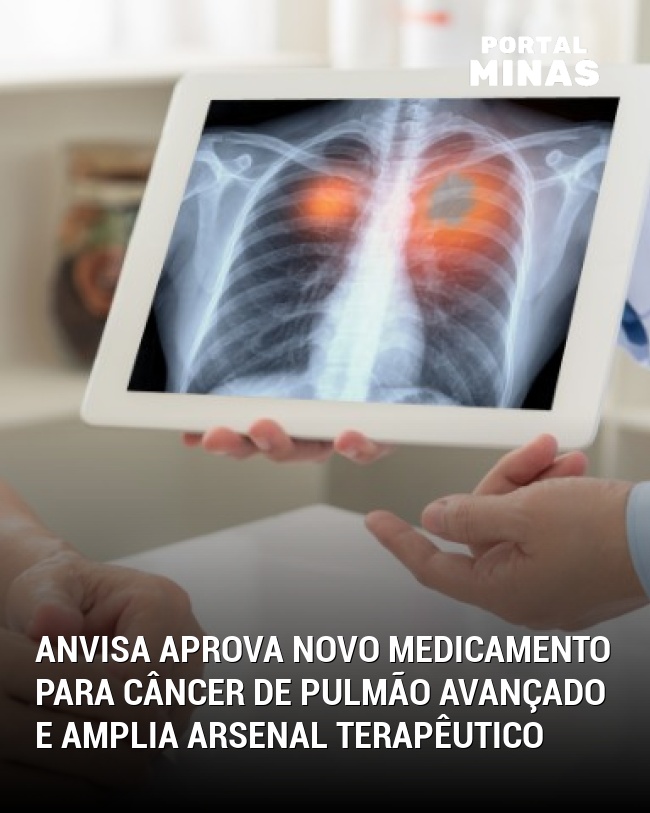 Anvisa aprova novo medicamento para câncer de pulmão avançado e amplia arsenal terapêutico