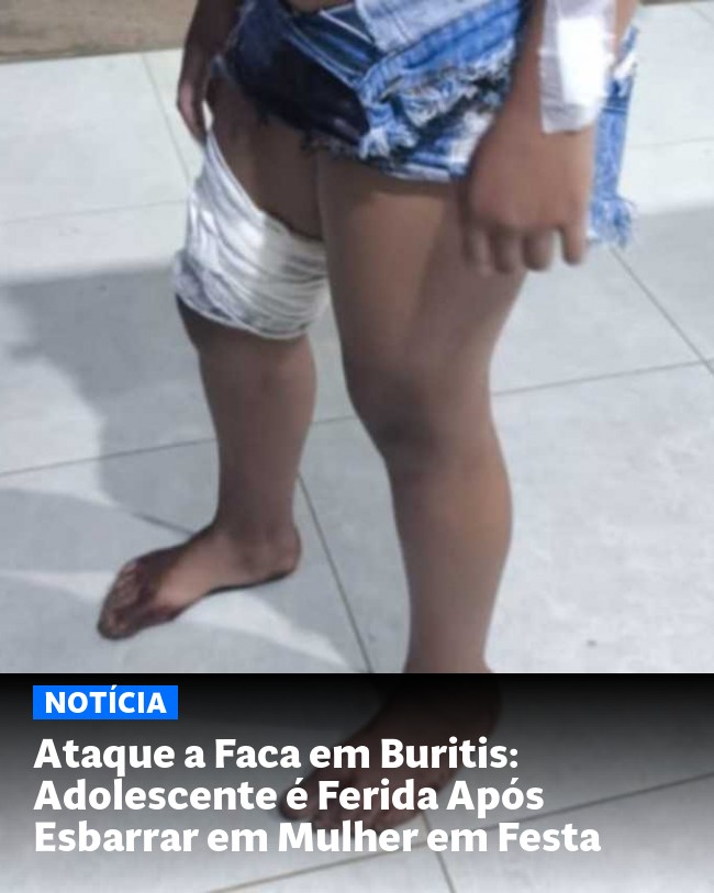Ataque a Faca em Buritis: Adolescente é Ferida Após Esbarrar em Mulher em Festa - Post para compartilhamento via WhatsApp
