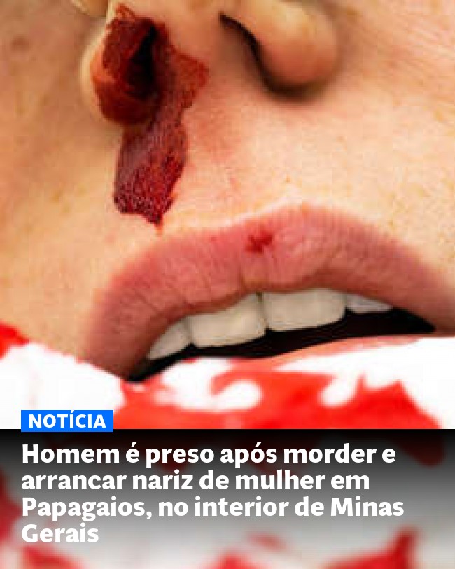 Homem é preso após morder e arrancar nariz de mulher em Papagaios, no interior de Minas Gerais - Post para compartilhamento via WhatsApp