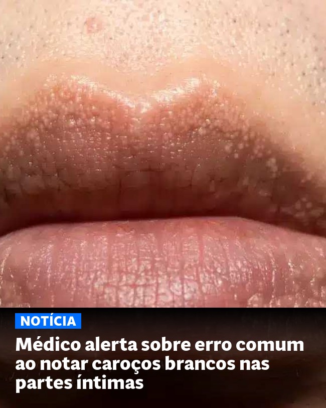 Médico alerta sobre erro comum ao notar caroços brancos nas partes íntimas - Post para compartilhamento via WhatsApp