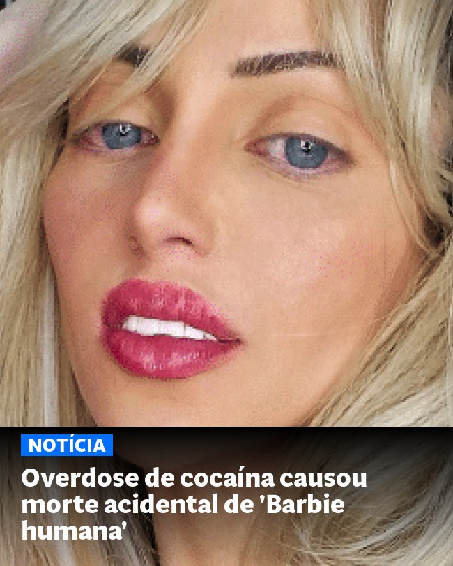 Overdose de cocaína causou morte acidental de 'Barbie humana' - Post para compartilhamento via WhatsApp