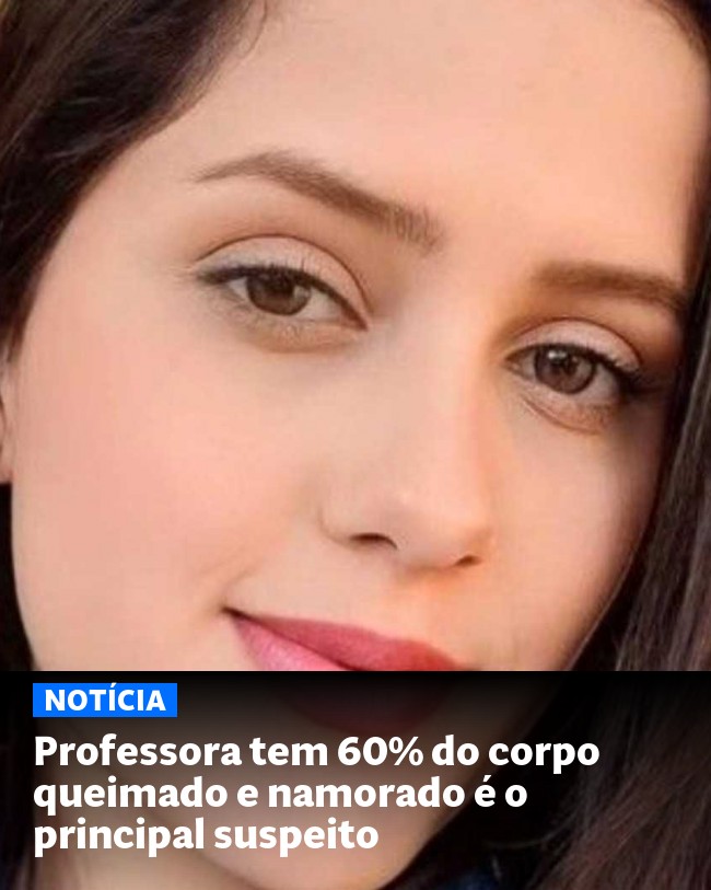 Professora tem 60% do corpo queimado e namorado é o principal suspeito - Post para compartilhamento via WhatsApp