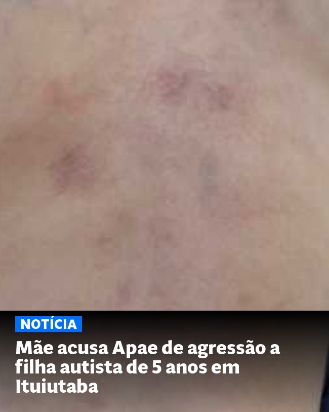 Mãe acusa Apae de agressão a filha autista de 5 anos em Ituiutaba - Post para compartilhamento via WhatsApp