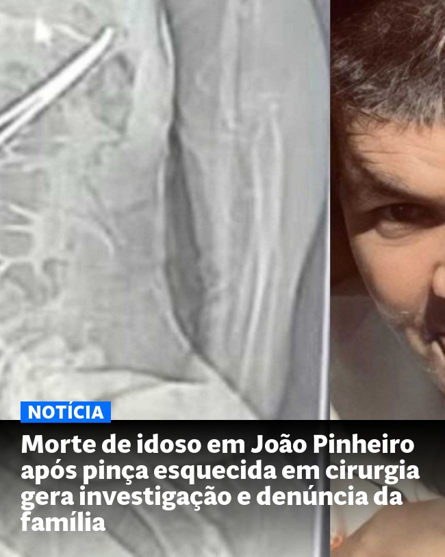 Morte de idoso em João Pinheiro após pinça esquecida em cirurgia gera investigação e denúncia da família - Post para compartilhamento via WhatsApp