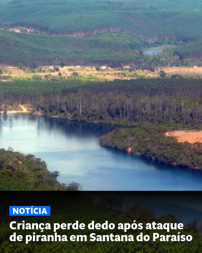 Criança perde dedo após ataque de piranha em Santana do Paraíso - Post para compartilhamento via WhatsApp