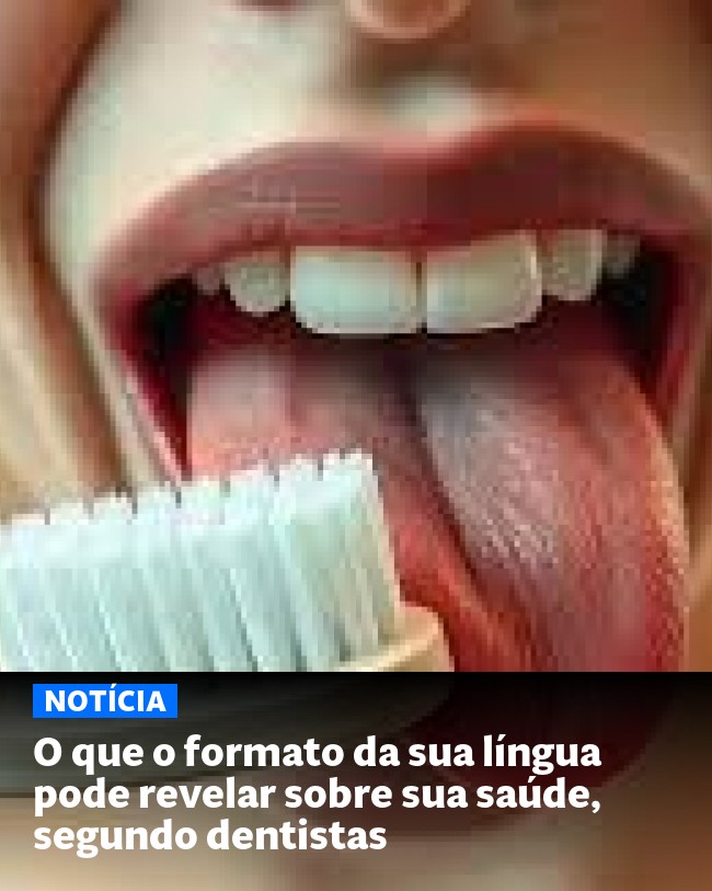 O que o formato da sua língua pode revelar sobre sua saúde, segundo dentistas - Post para compartilhamento via WhatsApp