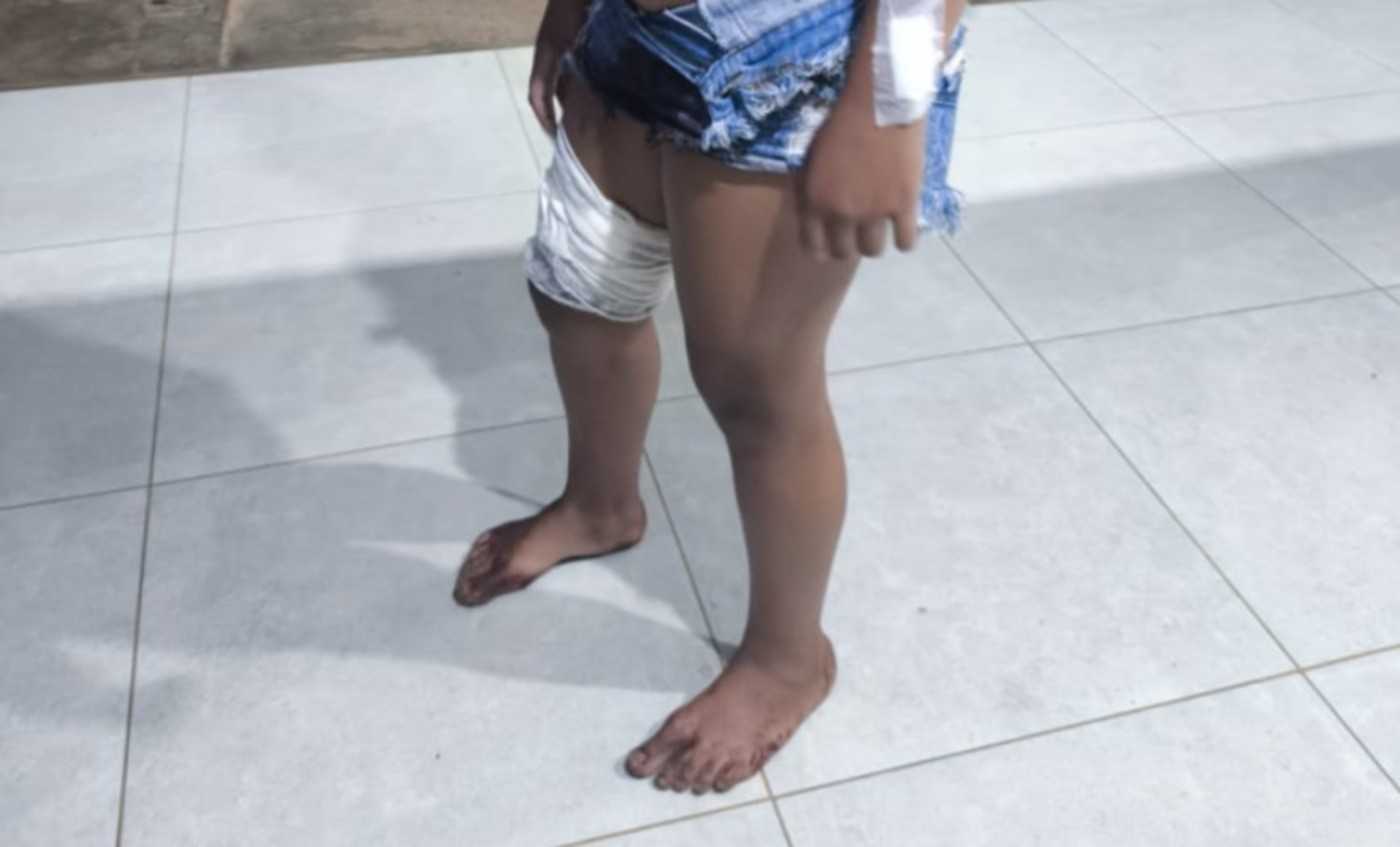 Ataque a Faca em Buritis: Adolescente é Ferida Após Esbarrar em Mulher em Festa
