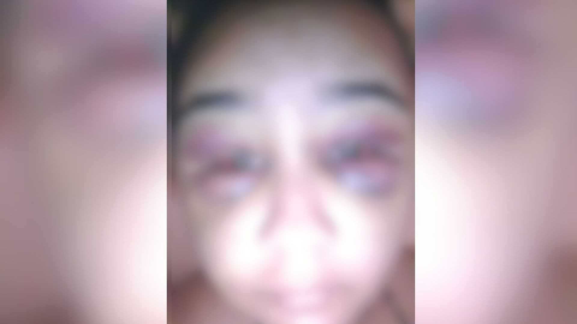 Violência em Araguari: Jovem é Brutalmente Agredida por Ex-Namorado ao Retornar de Viagem