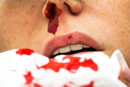 Homem é preso após morder e arrancar nariz de mulher em Papagaios, no interior de Minas Gerais