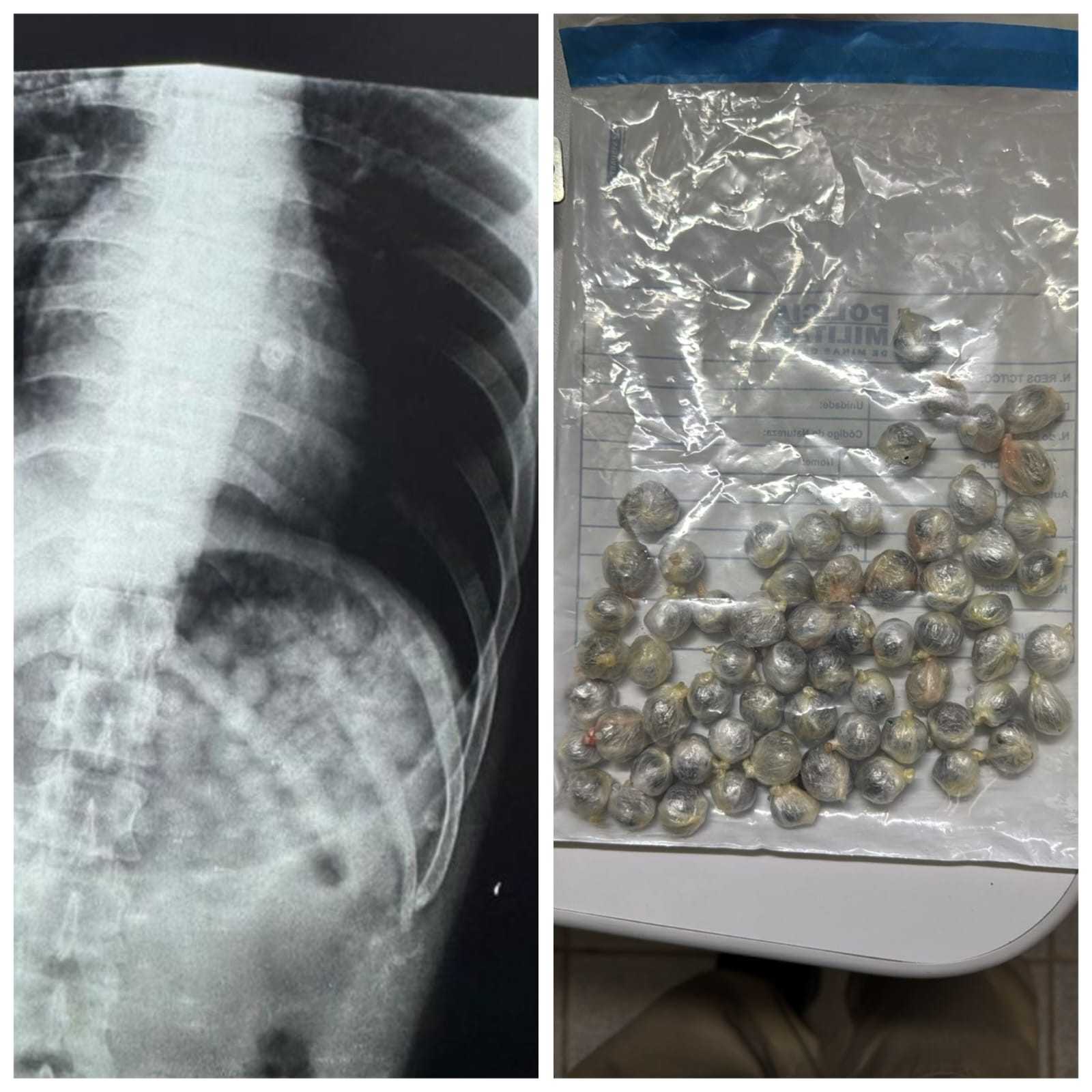 Detento em saída temporária passa mal após engolir 61 buchas de maconha em Pirapora, MG