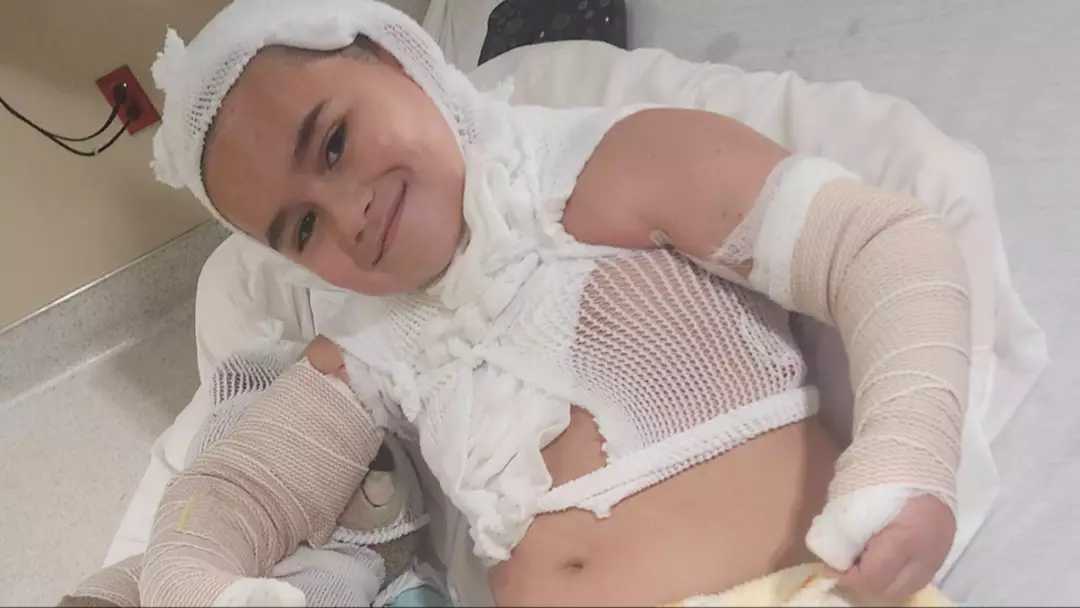 Menino de 8 anos achou que “ia morrer” após levar um choque de um carregador de celular na cama