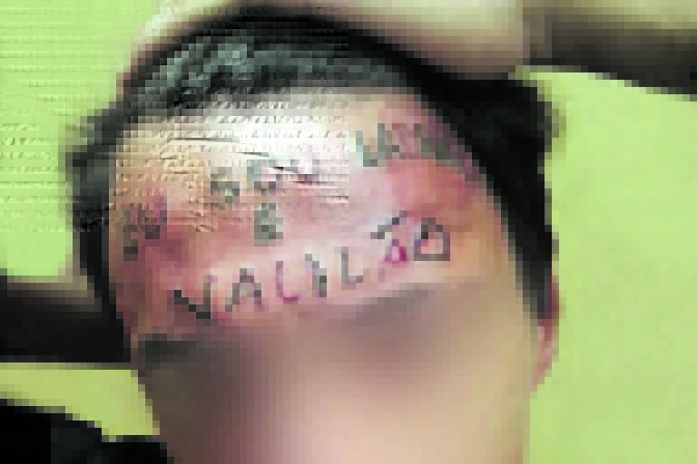 Homem da tatuagem 'ladrão e vacilão' na testa é preso em flagrante após invadir unidade de saúde