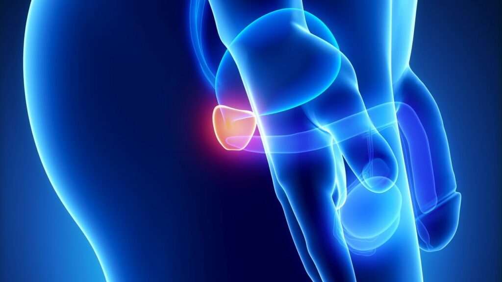 Uma nova pesquisa divulgada na prestigiada revista científica European Urology traz à tona um achado interessante para a saúde masculina. O estudo suger...