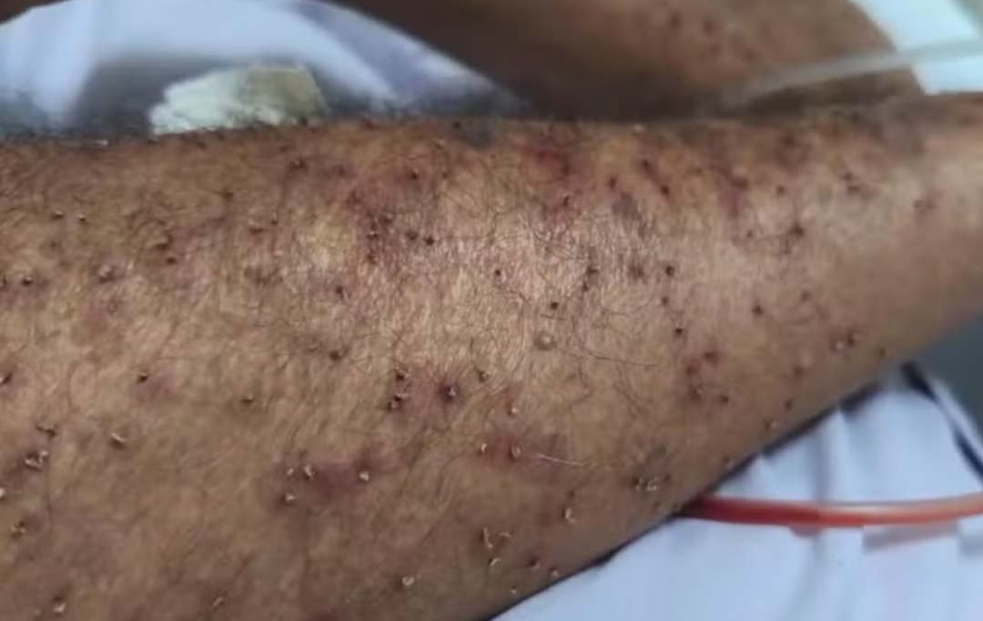 Um trágico incidente abalou Ponto dos Volantes, no Vale do Jequitinhonha, com a confirmação da morte de Gerolino Alves de Jesus, de 80 anos, nesta quart...