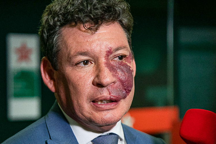 O deputado federal Reginaldo Lopes tem enfrentado forte resistência de trabalhadores e representantes trabalhistas ao sugerir, em entrevista ao SBT News...
