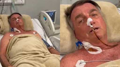 O ex-presidente Jair Bolsonaro registra uma evolução clínica favorável após passar por uma intervenção cirúrgica no ombro direito. O mais recente boleti...