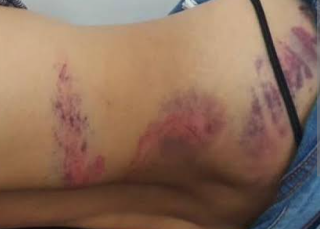 Uma mulher de 30 anos sofreu ferimentos graves na noite desta terça-feira (5), em Timóteo, após ser agredida pelo próprio companheiro, de 42 anos. O hom...