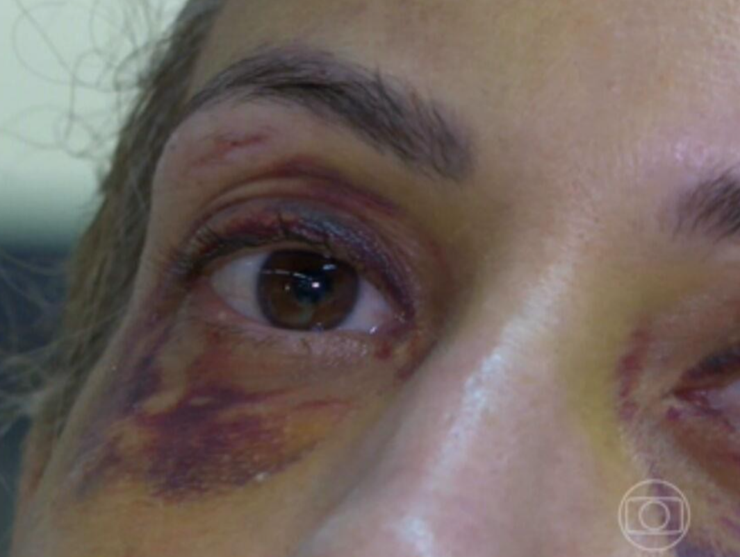 Uma mulher de 52 anos foi brutalmente agredida com socos e chutes pelo próprio filho, de 33 anos, nesta segunda-feira (11), em Patos de Minas, no Alto P...