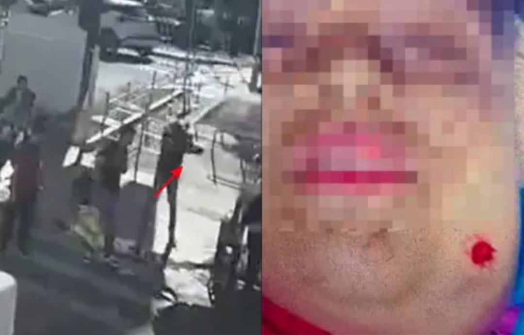 Uma mulher autista de 29 anos foi atingida por um disparo no rosto em Goiânia, Goiás, em um incidente violento ocorrido após ela sorrir para um homem de...