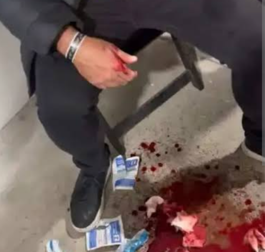O vereador Flávio Marra, representante do município de Divinópolis, tornou-se alvo de uma acusação de agressão. Um boletim de ocorrência, formalizado pe...